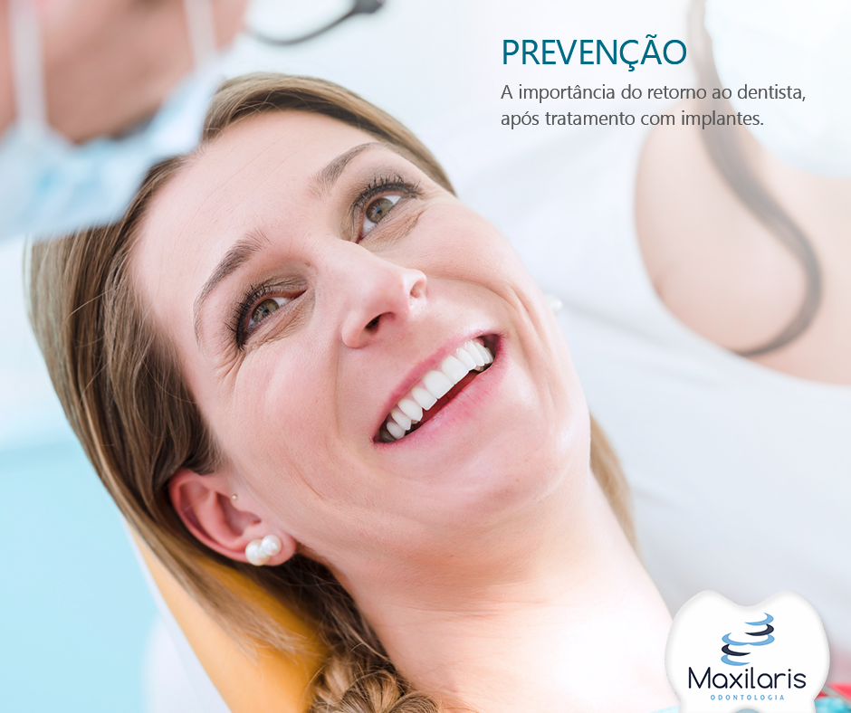 Preven O A Importancia Do Retorno Ao Dentista Ap S O Tratamento De Implantes Maxilaris